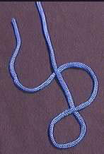 Stevedore Knot